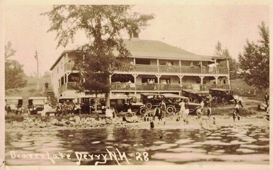 The Derry Museum of History's exhibit on Beaver Lake, encapsulating its rich history from ecological transformations to leisurely pursuits.